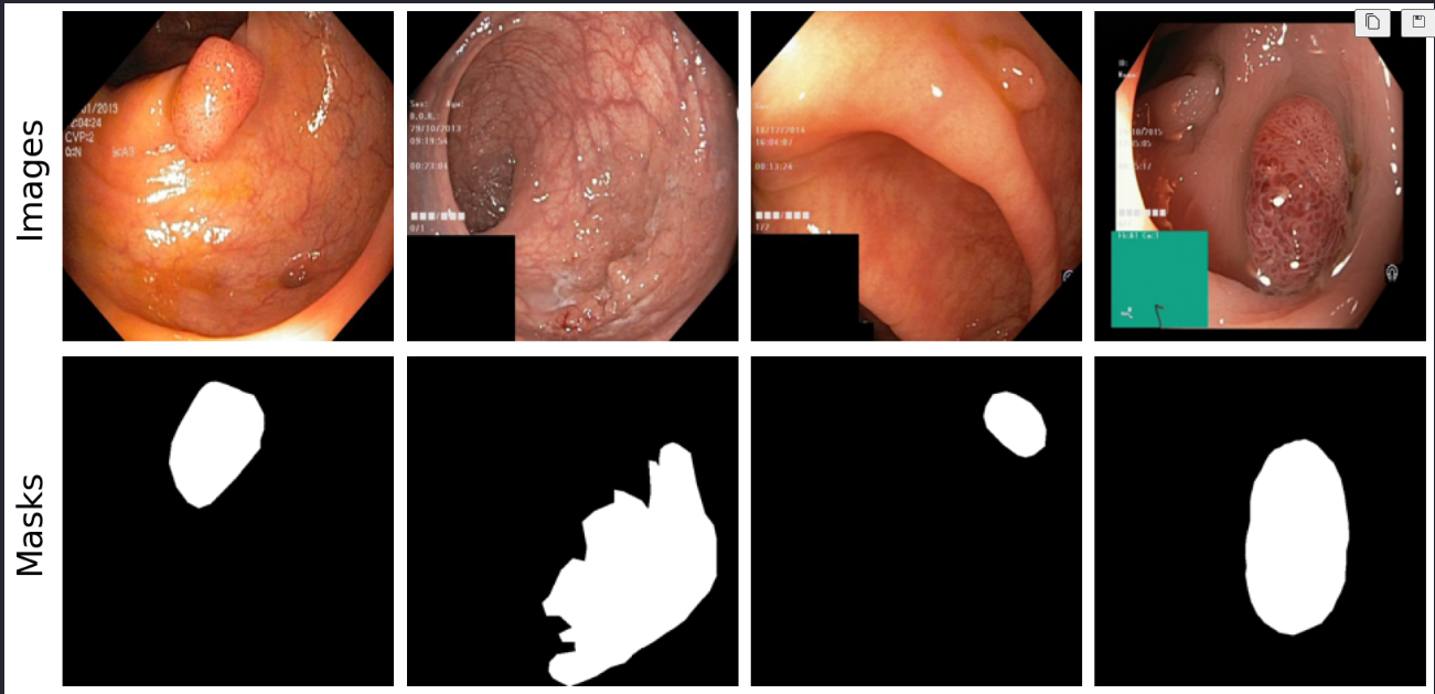 Medical Image Segmentation